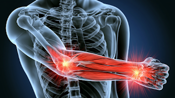 3D Medical Visualization of Human Upper Torso with Inflammation Highlights