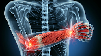 3D Medical Visualization of Upper Torso with Muscle and Pain Points