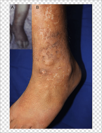 A) Photograph brought by the patient's mother showing the ...