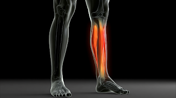 Anatomical Visualization of Lower Legs with Inflammation Effect