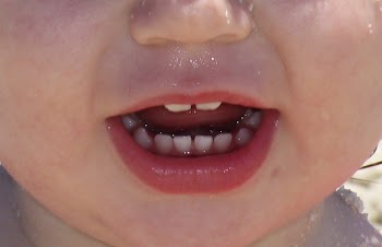 babyteeth2.jpg