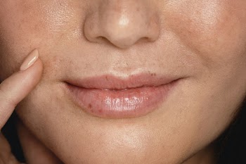Beautiful freckles close up, on female | Free Photo - rawpixel