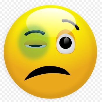 Black eye Bruise Smiley Clip art - Sick Smiley Cliparts 