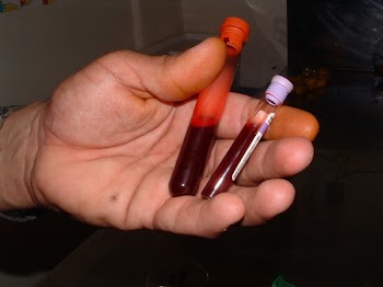 blood.jpg