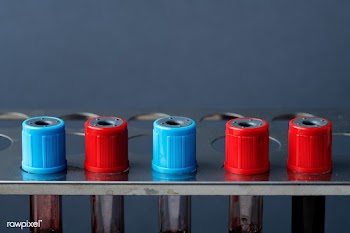 Blood samples in a test tube rack | Free  photo - 2295914