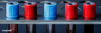 Blood samples in a test tube rack | Free  photo - 2296321