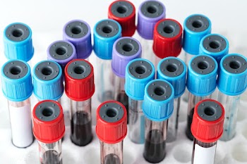 Blood samples in a test tube rack | Free  photo - 2297438