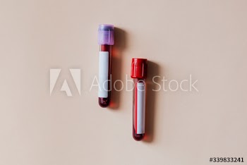 Blood test tubes on a beige background