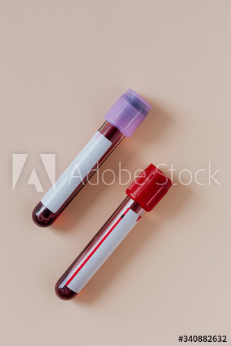 Blood test tubes on a beige background