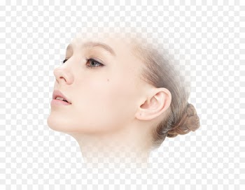 Botulinum toxin Plastic surgery Cheek Nose Chin - botox outline 