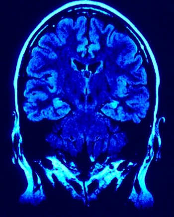 brain01.jpg