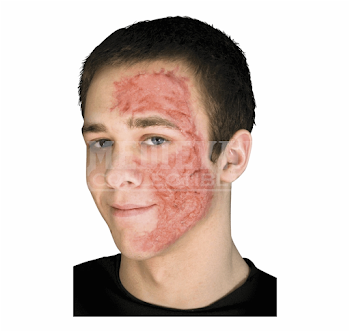 Burn Scar Face Free PNG Images & Clipart Download #414132 - Sccpre.Cat