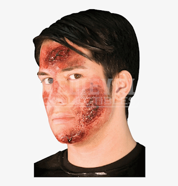 Burn Scar Png Graphic Freeuse Stock - Rotting Rash Latex ...