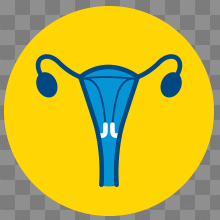 Cervical cancer (C53) - Cancer Council NSW