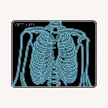 Chest X-ray clipart, medical illustration | Free Vector - rawpixel