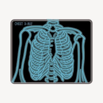Chest X-ray sticker, medical illustration | Free PSD - rawpixel