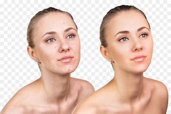 City Magnolia Day Spa Skin Face Cosmetics Acne - female skin care 