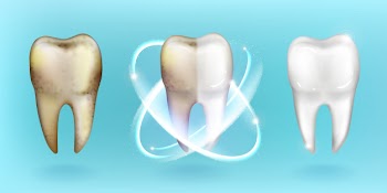 Clean and dirty tooth, whitening or clearing teeth Free Vector