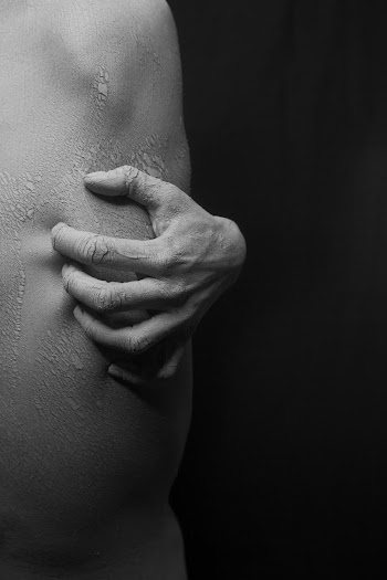 Close-up Photo Of A Person,s Hand Scratching    On His Flaky Skin In Black And White  