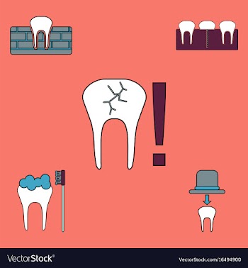 Collection of icons and dental disease vector image