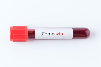Coronavirus blood test tube  | Free  psd mockup - 2296283