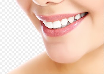 Cosmetic dentistry Smile Tooth whitening - US-tooth side 