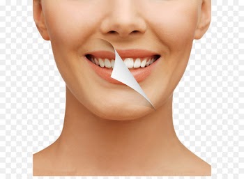 Cosmetic dentistry Tooth whitening Human tooth - Teeth Whitening 