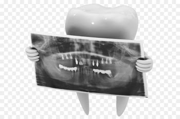 Dental radiography X-ray Dentistry Tooth - Dental X-ray film 