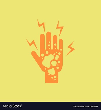 Dermatological effects on hand various symptoms vector image
