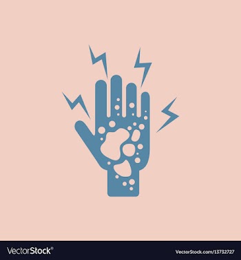 Dermatological effects on hand various symptoms vector image