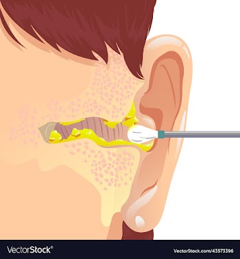dirty ear