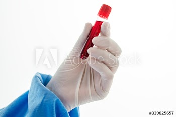 Doctor holding a blood test tube