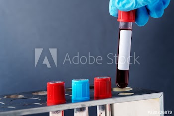 Doctor holding a blood test tube