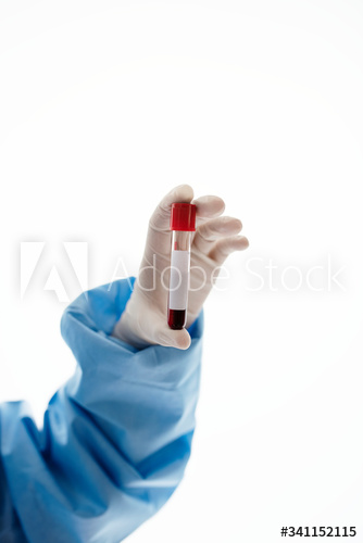 Doctor holding a blood test tube