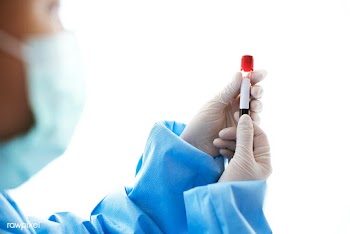 Doctor holding a blood test tube | Free  photo - 2295839