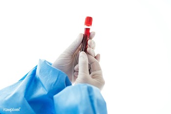Doctor holding a blood test tube | Free  photo - 2296347
