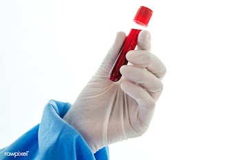 Doctor holding a blood test tube | Free  photo - 2296771