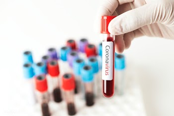 Doctor holding a blood test tube mockup | Free  psd mockup - 2295540
