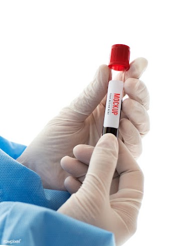 Doctor holding a blood test tube mockup | Free  psd mockup - 2296254
