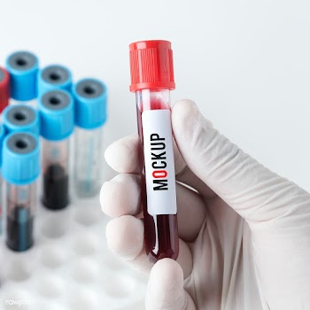 Doctor holding a blood test tube mockup | Free  psd mockup - 2296331