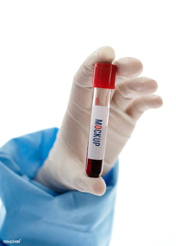 Doctor holding a blood test tube mockup | Free  psd mockup - 2296377