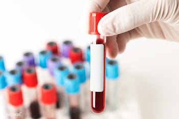 Doctor holding a blood test tube transparent png | Free  transparent png - 2295543