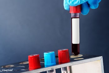 Doctor holding a blood test tube transparent png | Free  transparent png - 2295553