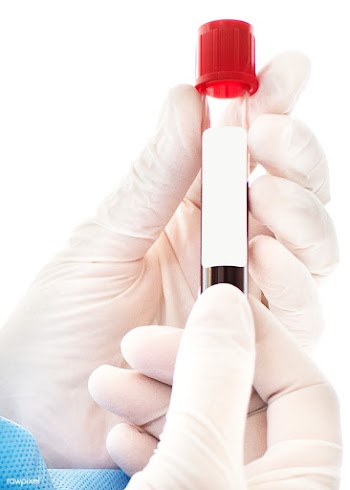 Doctor holding a blood test tube transparent png | Free  transparent png - 2296243