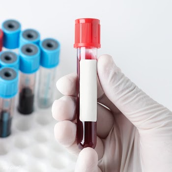 Doctor holding a blood test tube transparent png | Free  transparent png - 2296319