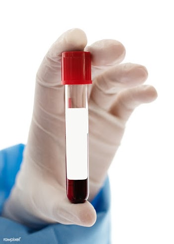 Doctor holding a blood test tube transparent png | Free  transparent png - 2296376