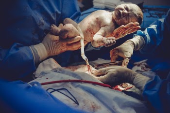 Doctor Holding Baby