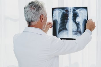 Doctor looking at chest x-ray Free Photo