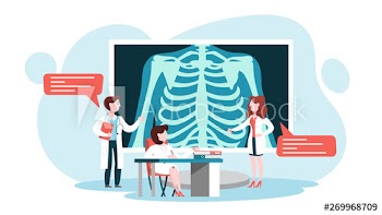 Doctor standing around a big x-ray image of chest