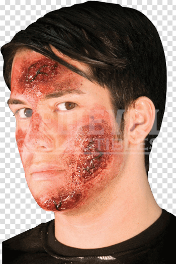 Download Burn Scar Png Graphic Freeuse Stock - Rotting Rash Latex ...
